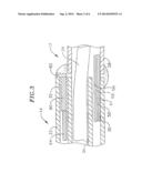 CATHETER HAVING CIRCULAR ABLATION ASSEMBLY diagram and image