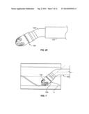 ATHERECTOMY DEVICES AND METHODS diagram and image