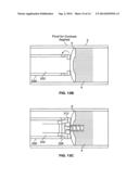 ATHERECTOMY DEVICES AND METHODS diagram and image