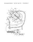 ABLATION DEVICES WITH SENSORS STRUCTURES diagram and image