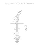 CATHETER WITH OCCLUDING CUFF diagram and image