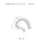 CATHETER WITH OCCLUDING CUFF diagram and image