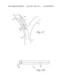 CATHETER WITH OCCLUDING CUFF diagram and image