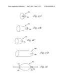 CATHETER WITH OCCLUDING CUFF diagram and image