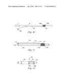 CATHETER WITH OCCLUDING CUFF diagram and image