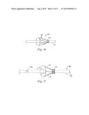 CATHETER WITH OCCLUDING CUFF diagram and image