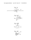 CATHETER WITH OCCLUDING CUFF diagram and image