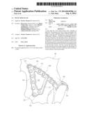 PELVIC BONE PLATE diagram and image