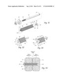 SYSTEMS AND METHODS FOR THE FIXATION OR FUSION OF BONE USING COMPRESSIVE     IMPLANTS diagram and image