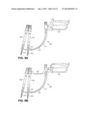 Rod Insertion Tools, Rods and Methods diagram and image