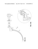 Rod Insertion Tools, Rods and Methods diagram and image