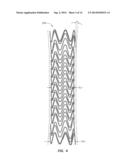 ELECTROSPUN PTFE COATED STENT AND METHOD OF USE diagram and image