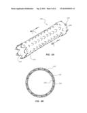 ELECTROSPUN PTFE COATED STENT AND METHOD OF USE diagram and image