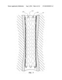 ELECTROSPUN PTFE COATED STENT AND METHOD OF USE diagram and image