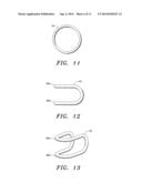 Anchored Cardiovascular Valve diagram and image