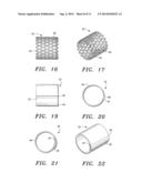 Anchored Cardiovascular Valve diagram and image