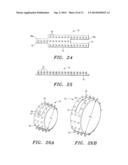 Anchored Cardiovascular Valve diagram and image