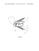 ZERO-PROFILE EXPANDABLE INTERVERTEBRAL SPACER DEVICES FOR DISTRACTION AND     SPINAL FUSION AND A UNIVERSAL TOOL FOR THEIR PLACEMENT AND EXPANSION diagram and image