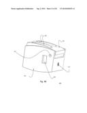 ZERO-PROFILE EXPANDABLE INTERVERTEBRAL SPACER DEVICES FOR DISTRACTION AND     SPINAL FUSION AND A UNIVERSAL TOOL FOR THEIR PLACEMENT AND EXPANSION diagram and image