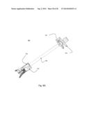 ZERO-PROFILE EXPANDABLE INTERVERTEBRAL SPACER DEVICES FOR DISTRACTION AND     SPINAL FUSION AND A UNIVERSAL TOOL FOR THEIR PLACEMENT AND EXPANSION diagram and image