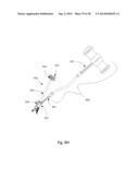 ZERO-PROFILE EXPANDABLE INTERVERTEBRAL SPACER DEVICES FOR DISTRACTION AND     SPINAL FUSION AND A UNIVERSAL TOOL FOR THEIR PLACEMENT AND EXPANSION diagram and image