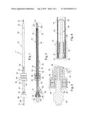 TISSUE PROSTHESIS INSERTION SYSTEM AND METHOD diagram and image