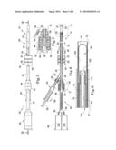 TISSUE PROSTHESIS INSERTION SYSTEM AND METHOD diagram and image