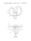 TIBIAL BASEPLATE WITH ASYMMETRIC PLACEMENT OF FIXATION STRUCTURES diagram and image