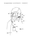 SINGLE-SIDED MODULAR OXYGEN CANNULA  AND GAS/Air Delivery System diagram and image