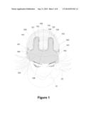 Hairpiece Having Dual Parting Areas diagram and image