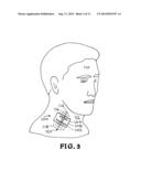 CONFORMAL, WEARABLE, THIN MICROWAVE ANTENNA FOR SUB-SKIN AND SKIN SURFACE     MONITORING diagram and image