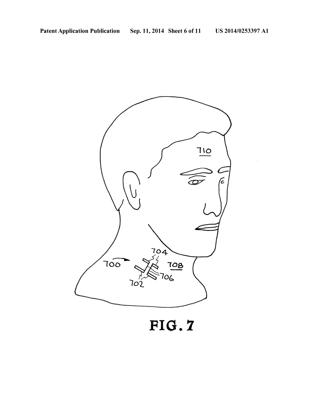 CONFORMAL, WEARABLE, THIN MICROWAVE ANTENNA FOR SUB-SKIN AND SKIN SURFACE     MONITORING - diagram, schematic, and image 07