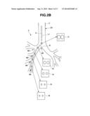 MEDICAL APPARATUS diagram and image