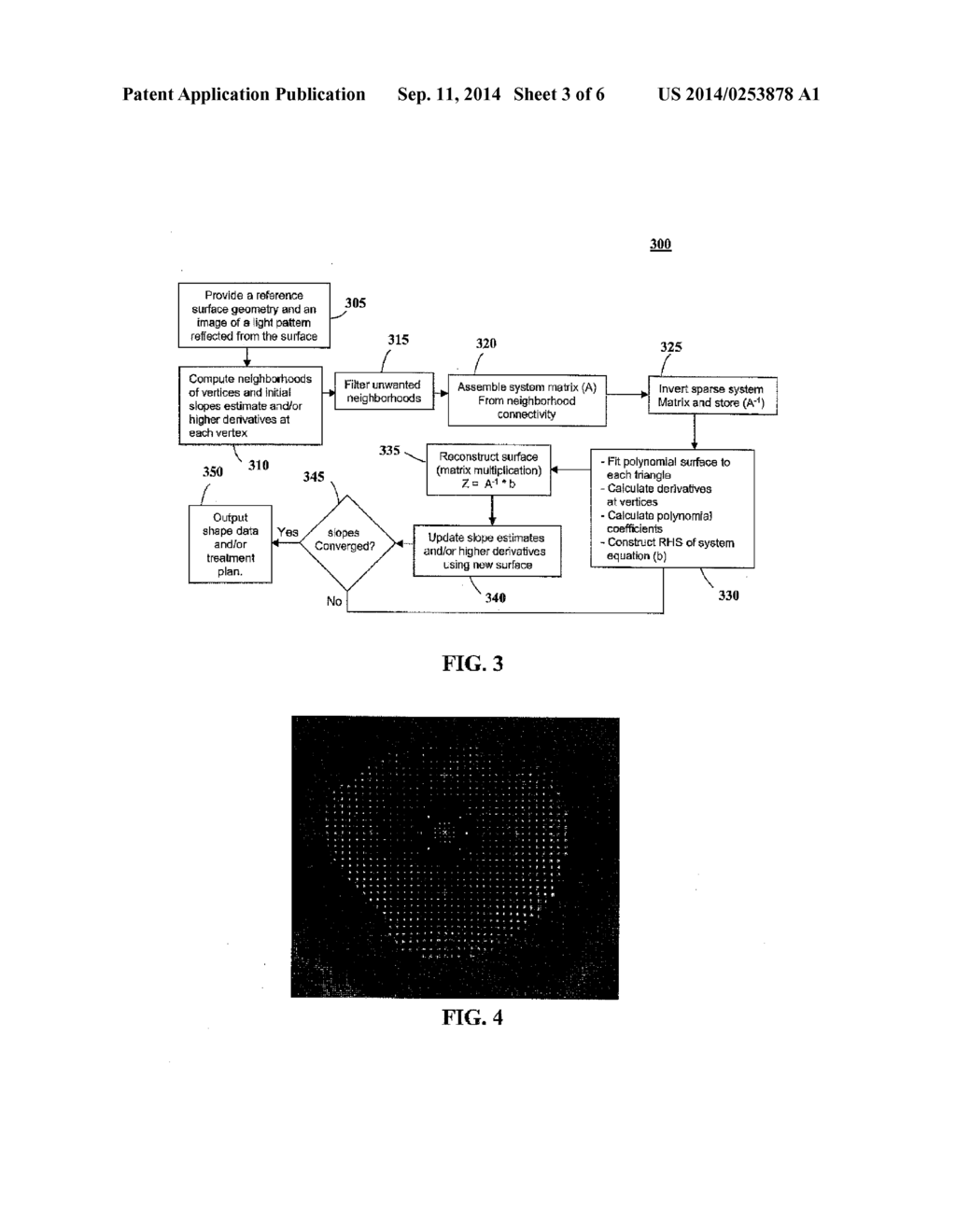 OPHTHALMIC SYSTEMS AND RELATED METHODS - diagram, schematic, and image 04