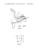 Tool For Insertion and Removal of In-Canal Hearing Devices diagram and image