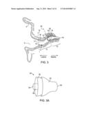 Tool For Insertion and Removal of In-Canal Hearing Devices diagram and image