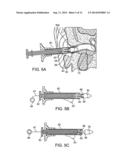 Tool For Insertion and Removal of In-Canal Hearing Devices diagram and image