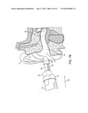 Tool For Insertion and Removal of In-Canal Hearing Devices diagram and image