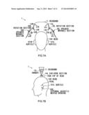 Ear Speaker Device diagram and image