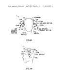 Ear Speaker Device diagram and image