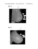 IMAGING DEVICE, ASSIGNMENT SYSTEM AND METHOD FOR ASSIGNMENT OF     LOCALIZATION DATA diagram and image