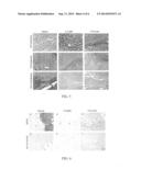 METHOD OF TREATING BRAIN TUMORS diagram and image