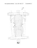 Systems and Methods for Analyzing Dynamic Dental Occlusions and Making     Dental Appliances diagram and image