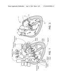 Inflatable Exhibit of a Human Heart and Method diagram and image