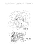 Inflatable Exhibit of a Human Heart and Method diagram and image