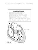 Inflatable Exhibit of a Human Heart and Method diagram and image