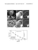 DIAGNOSIS OF MYOCARDIAL AUTOIMMUNITY IN HEART DISEASE diagram and image