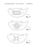 REINFORCED FACES OF CLUB HEADS AND RELATED METHODS diagram and image