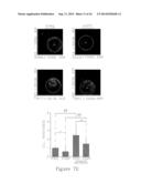 Compositions And Methods For Treating Glioma diagram and image