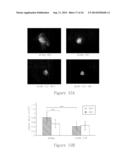 Compositions And Methods For Treating Glioma diagram and image